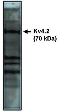 "
Western blot analysis
using Kv4.2 antibody on
rat brain lysate."